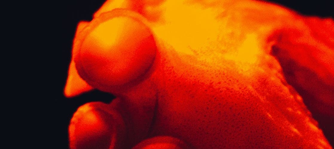 Install ArgoCD on an AKS cluster with NGINX